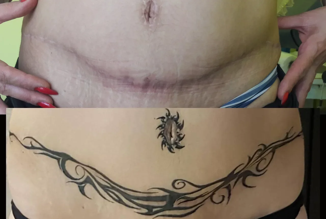 Cover-up tattoo